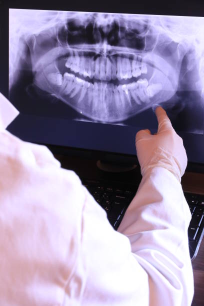 Best Emergency Wisdom Tooth Extraction in Dayton, KY
